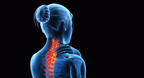 Woman with back and neck pain, showing spine.
